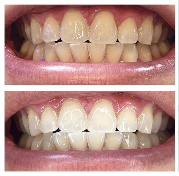 Chloe D. — Melbourne