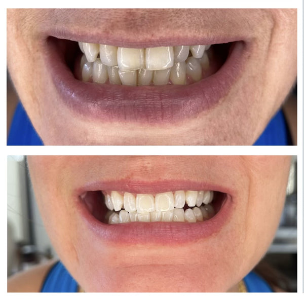 Emma R. — Gold Coast